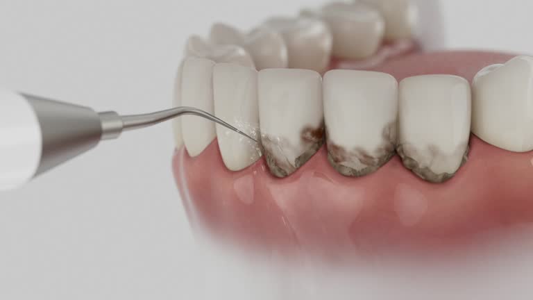 Trusted Tooth Extraction service in High Bridge, NJ - Dentist Open Now